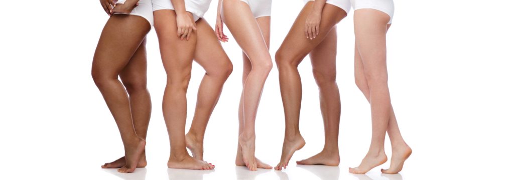 Is Sclerotherapy in Springfield Missouri Right For Me?